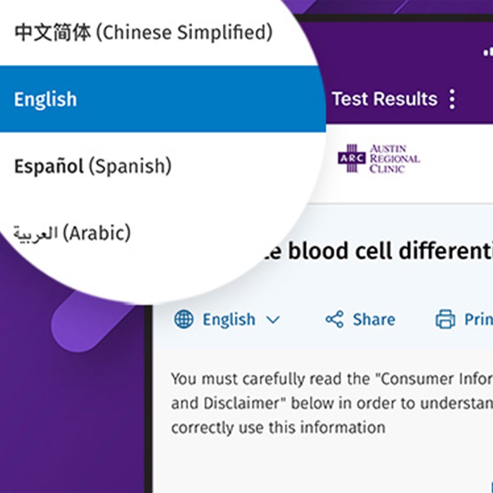 Example of different language options for patient education content in ARC MyChart