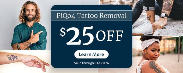 $25 off Tattoo Removal - April 2024