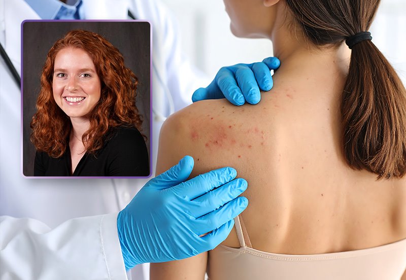 Dermatology specialist taking a look at a patient's skin rash on their upper back, and an image of Charlotte Wright Williamson, APRN, MSN, FNP-C, ARC Dermatology team member