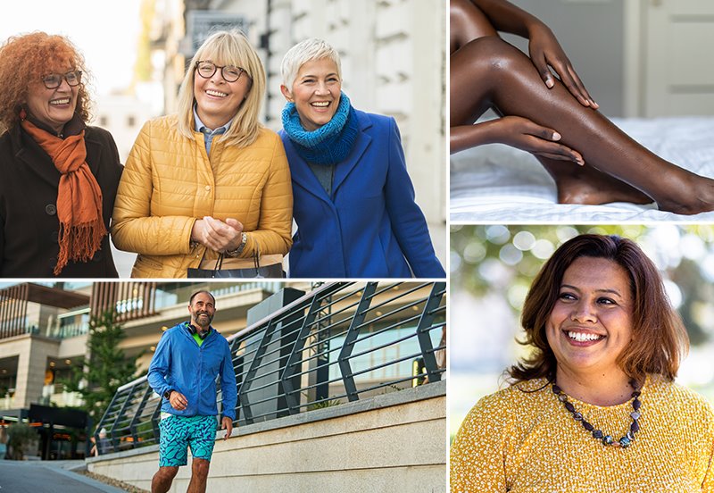 Collage featuring images of patients after Sclerotherapy and RF Microneedling + FemTouch treatments