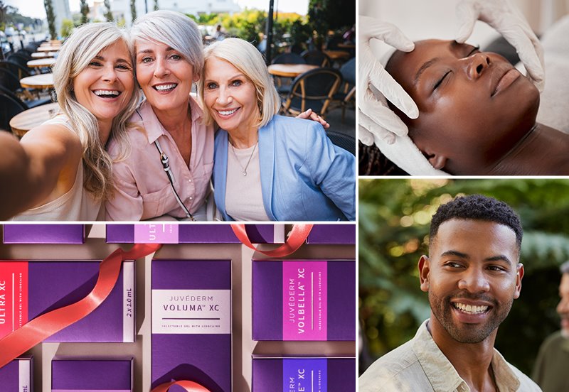 Collage featuring images of patients after ActiveFX™ Laser Resurfacing treatment and JUVÉDERM® fillers