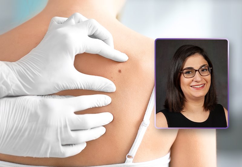 Dermatologist examining a patient's back during a skin cancer screening, and an image of Saba Zabetian, MD, Dermatologist at ARC