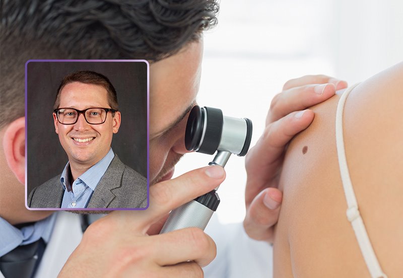 Patient getting a mole checked during a skin cancer screening and an image of Christian M. Wichterman, MD, FAAD, Dermatologist at ARC